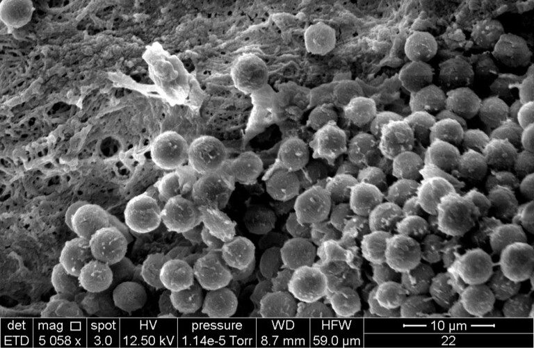 Biofilm-Gram-Positive-Cocci-Nutrimedic